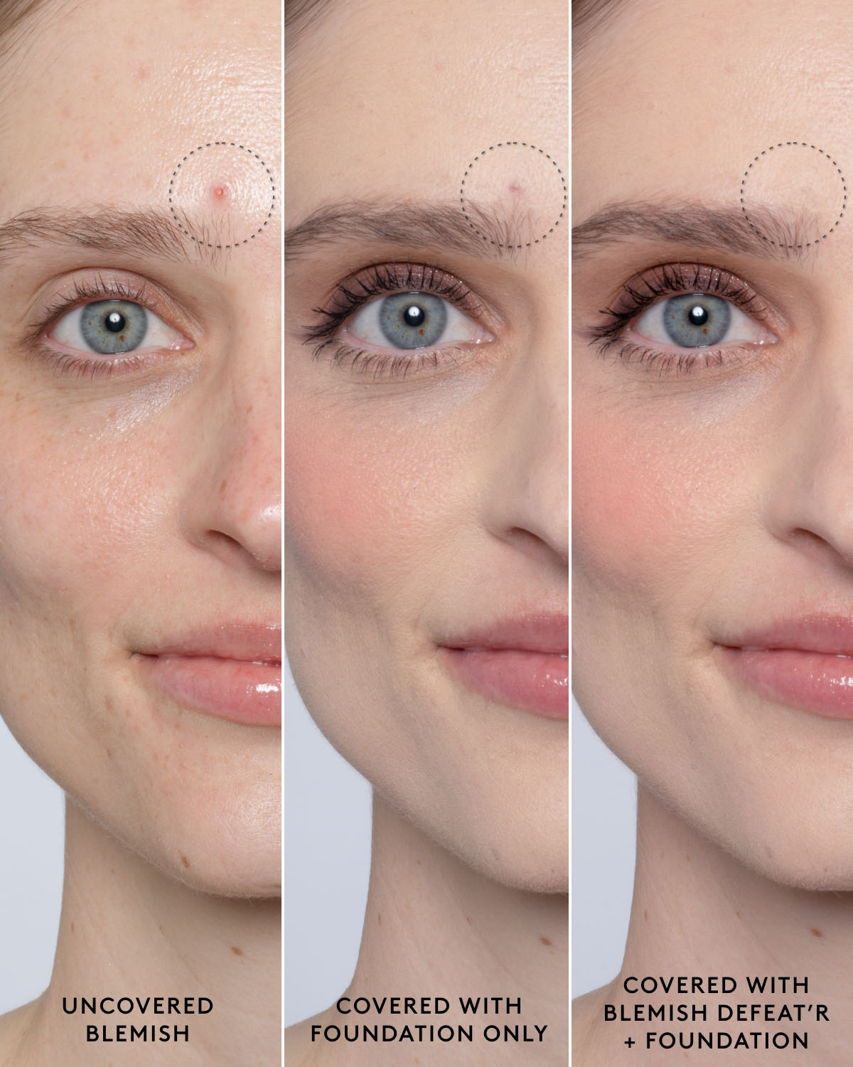 Blemish Defeat'r BHA Spot-Targeting Gel - Image 8