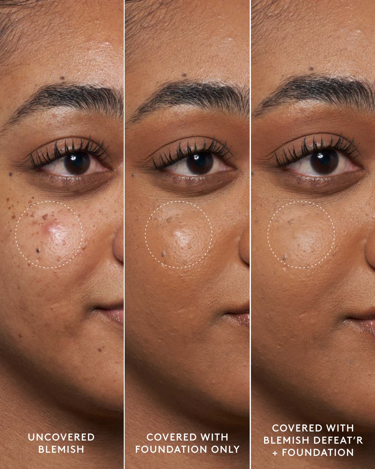Blemish Defeat'r BHA Spot-Targeting Gel - Image 2