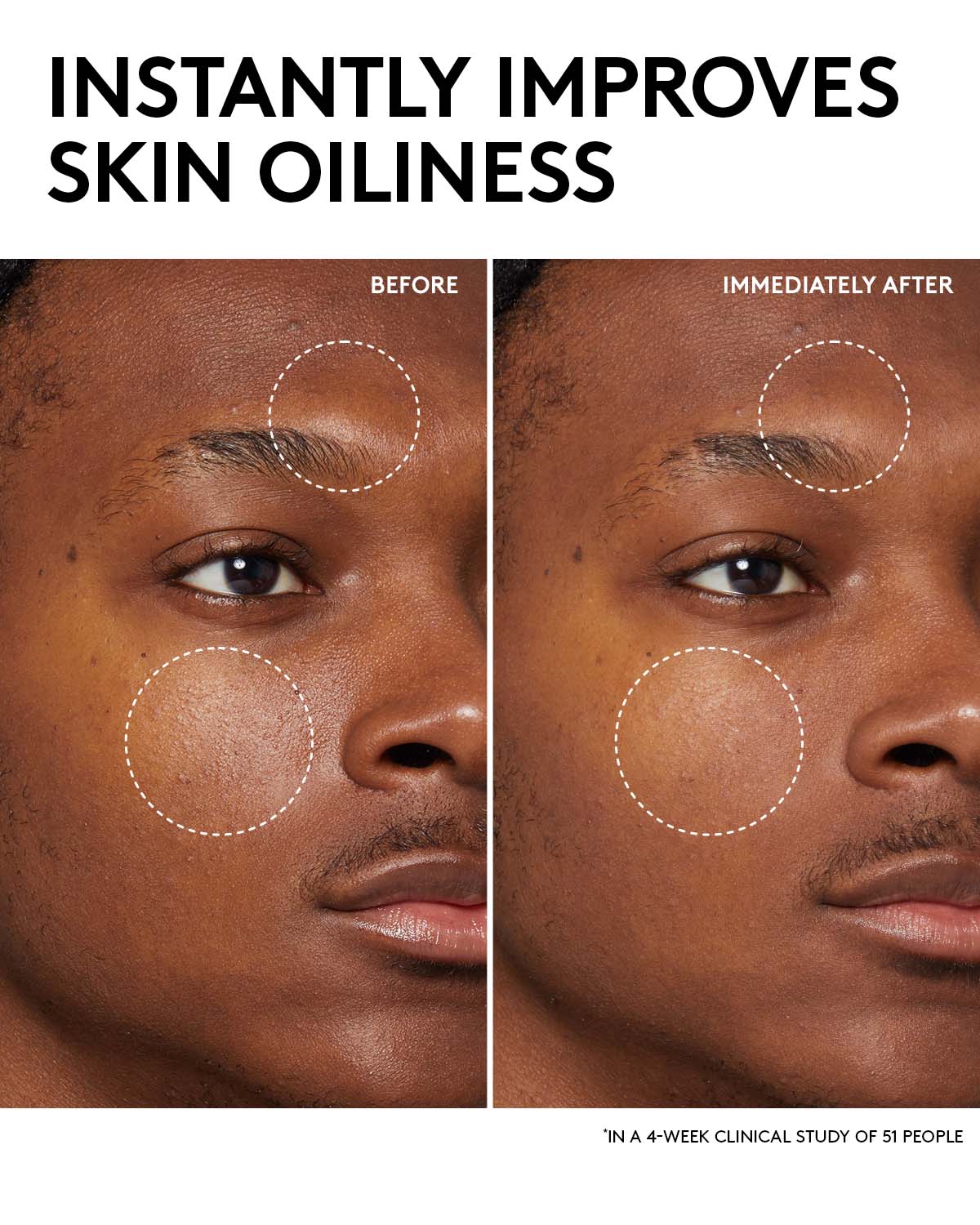 Fenty Skin Start'rs Full-Size Bundle with Mineral SPF: Oily Skin Edition - Image 12