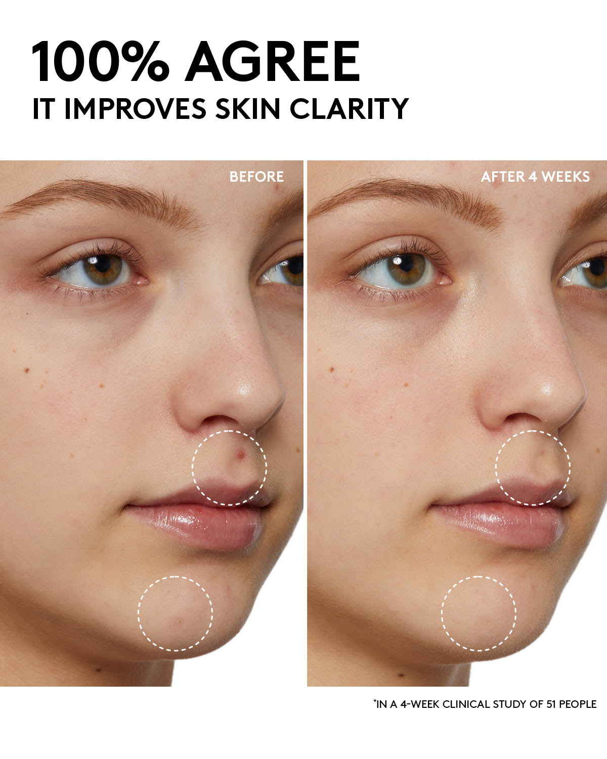 Fenty Skin Start'rs Full-Size Bundle with Mineral SPF: Oily Skin Edition - Image 13