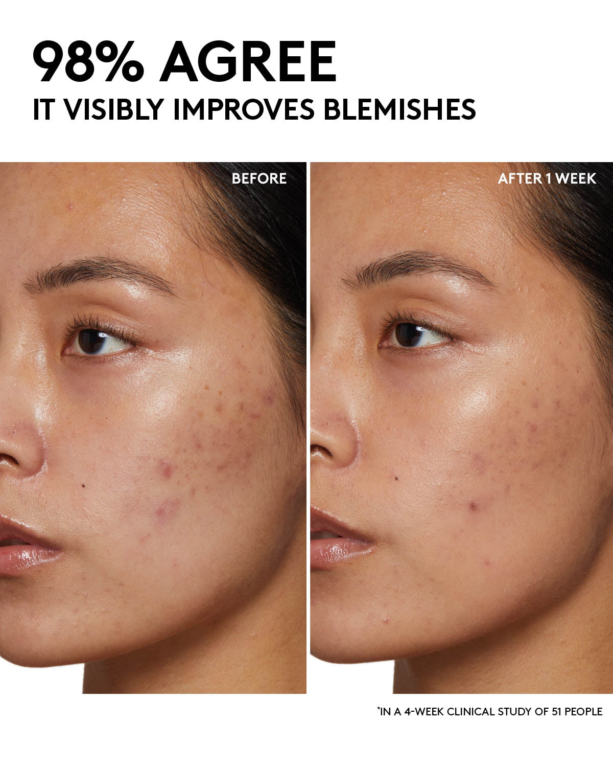 Fenty Skin Start'rs Full-Size Bundle with Mineral SPF: Oily Skin Edition - Image 14