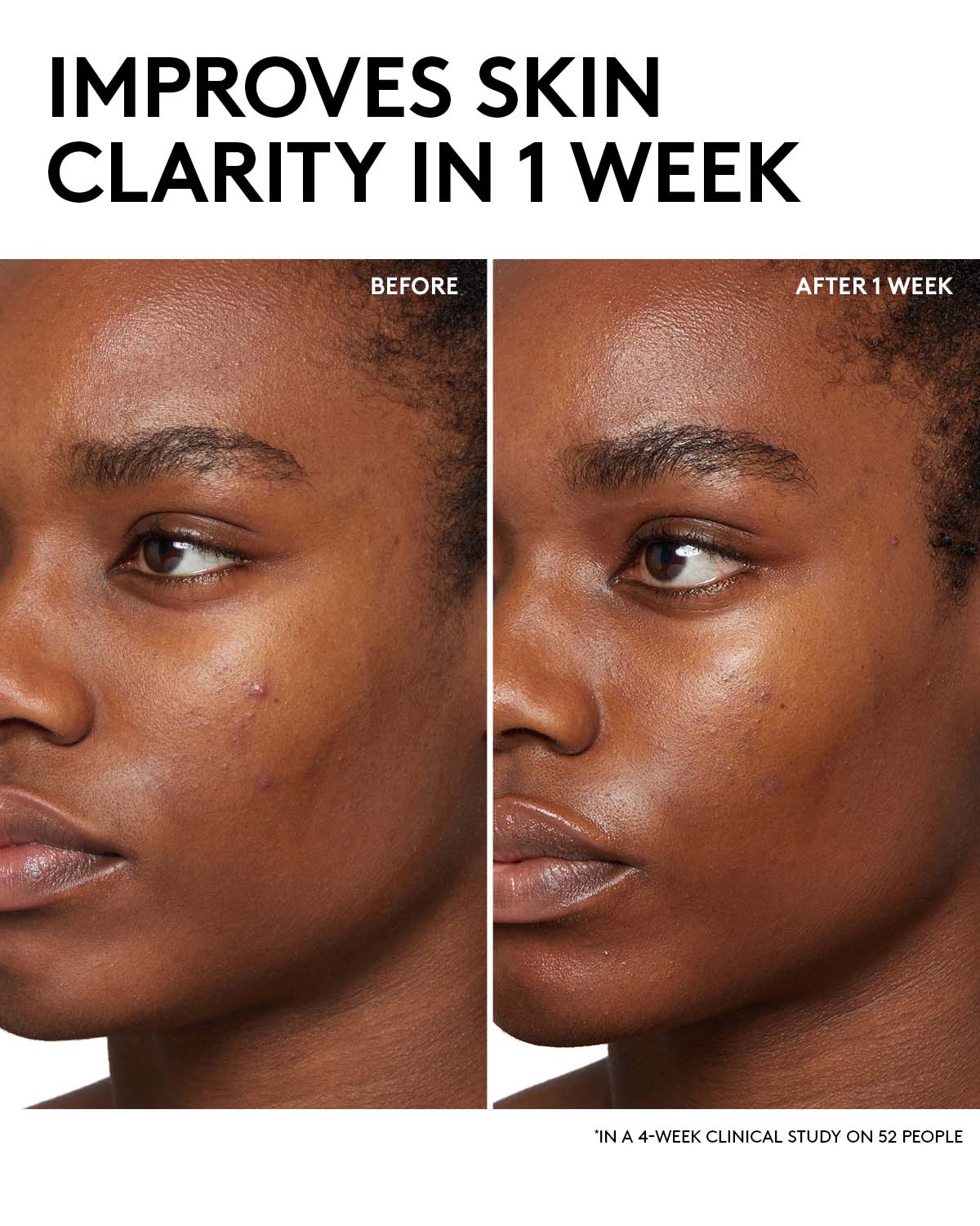 Fenty Skin Start'rs Full-Size Bundle with Mineral SPF: Oily Skin Edition - Image 3