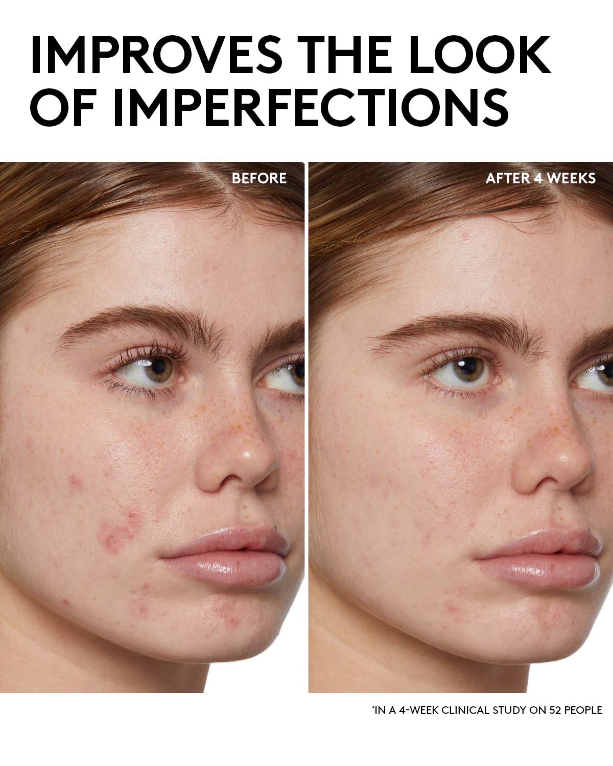 Fenty Skin Start'rs Full-Size Bundle with Mineral SPF: Oily Skin Edition - Image 4